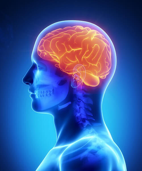 heat image of brain